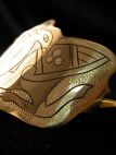 fibula 